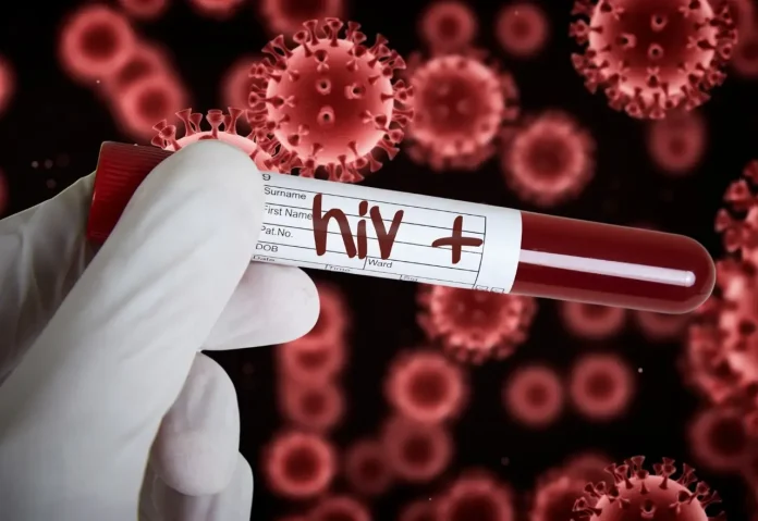 HIV-webp